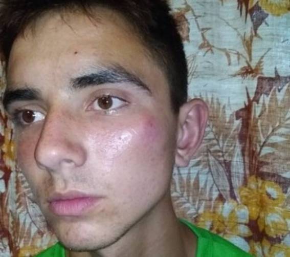 Водитель брянской маршрутки избил 16-летнего парня монтировкой