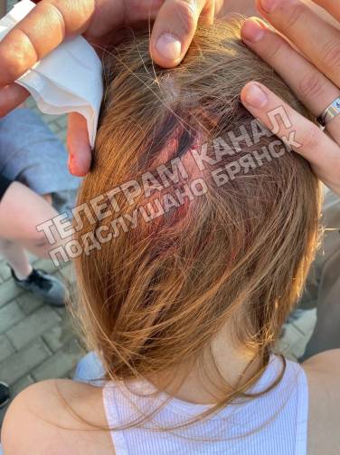 В брянском парке «Юность» под подростками сломались качели