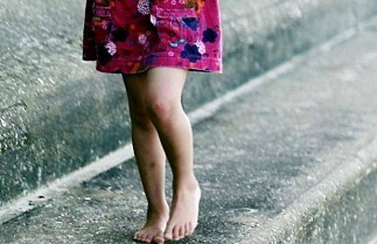 В Брянске 7-летнюю девочку с обмороженными ногами спас сосед 