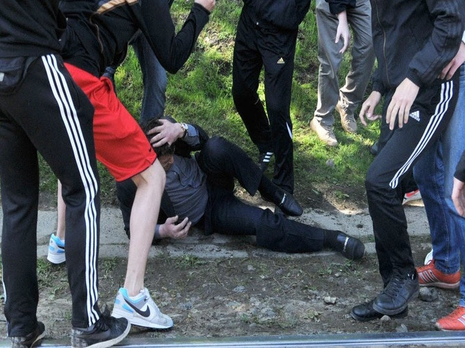 В Карачеве подростки жестоко избили пожилого человека