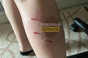 В Брянске на улице Белобережской бродячая собака напала на девочку