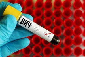 В Брянской области зарегистрировали 4453 ВИЧ-инфицированных