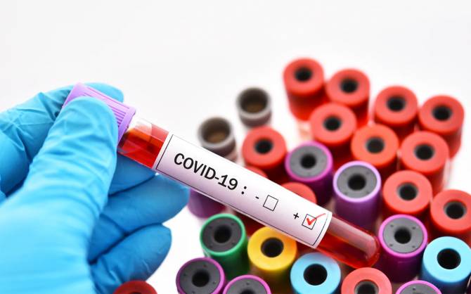 Озвучен процент заболевших после вакцинации от COVID-19 брянцев