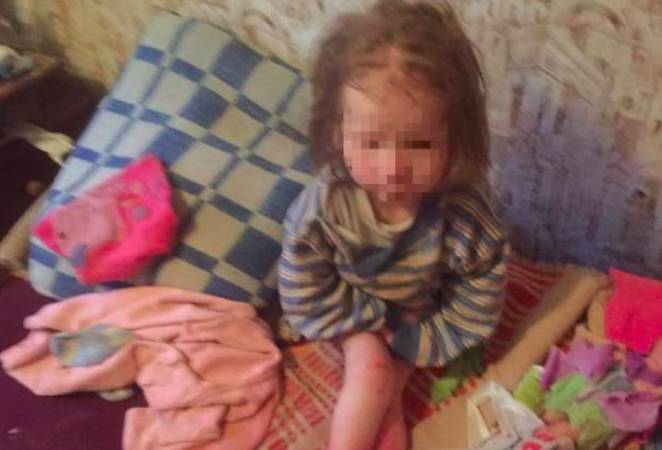 Истощенной 7-летней девочке ищут новых родителей в Брянске
