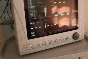 Брянские больницы получили новые кардиомониторы