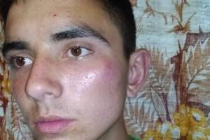Водитель брянской маршрутки избил 16-летнего парня монтировкой