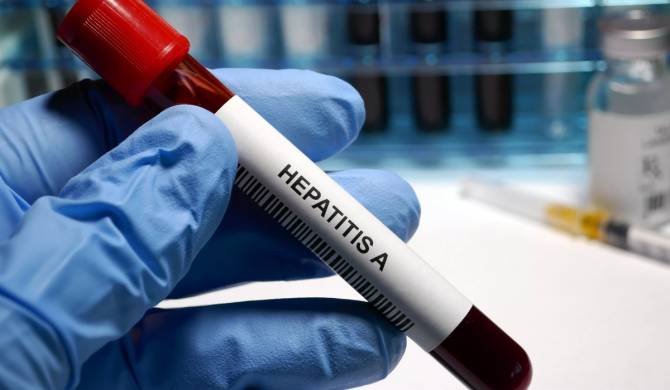 На Брянщине заболеваемость гепатитом А оказалась выше средней по России